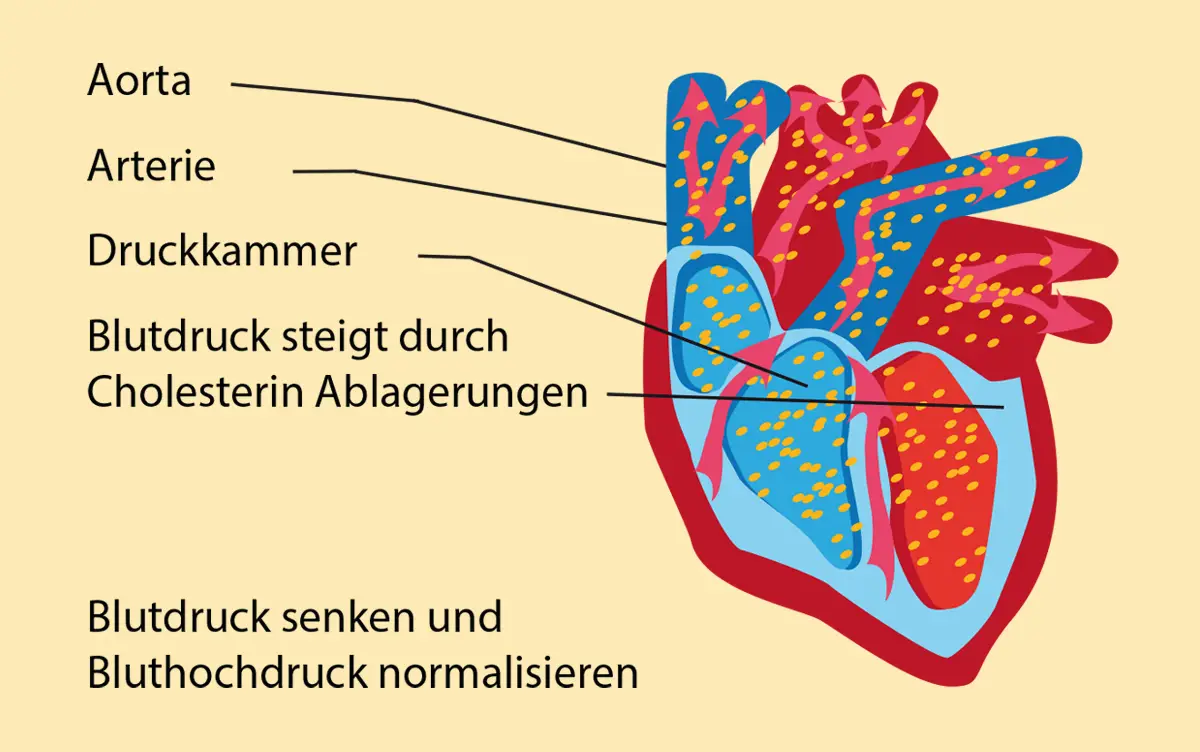 Blutdruck senken und normalisieren Grafik