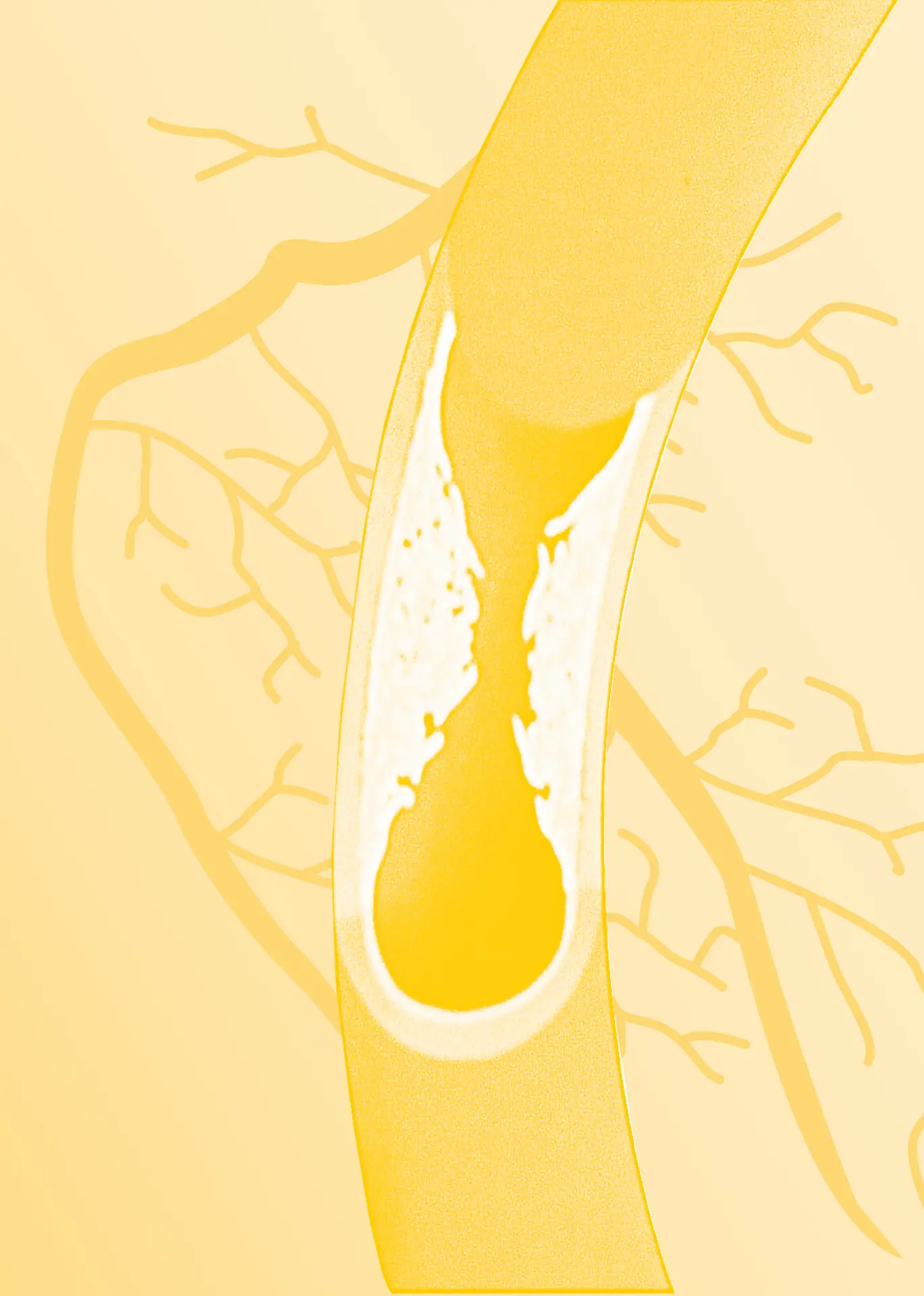 Themenübersicht zu Produkten rund um den Cholesterinspiegel